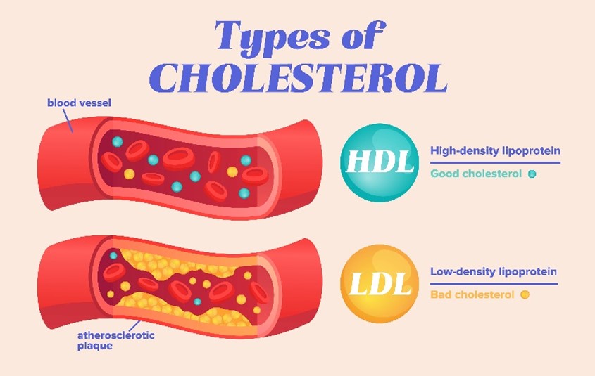 3 Steps to Improve Cholesterol Levels